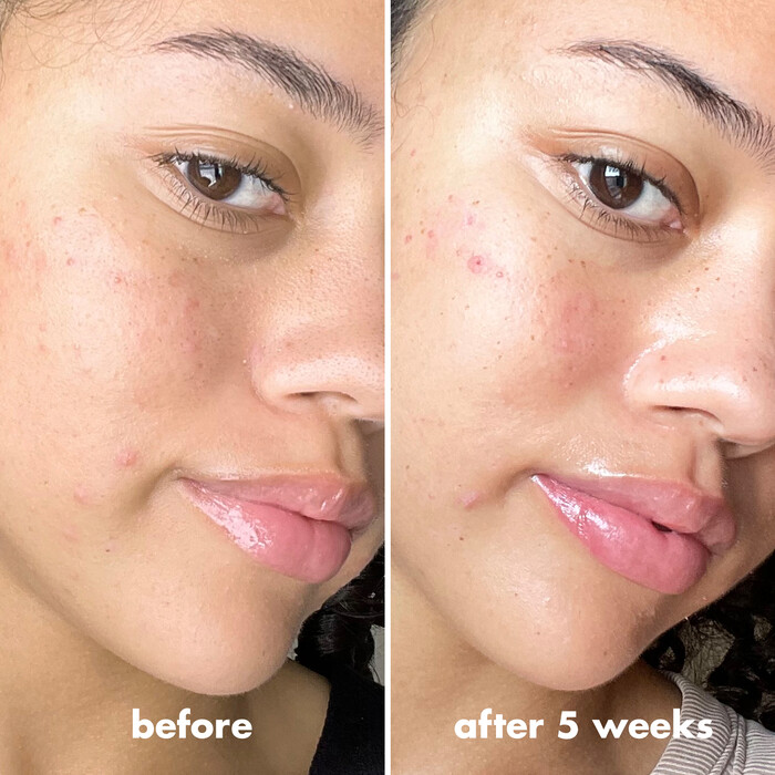 Before and After on Model Using Brightening Face Primer